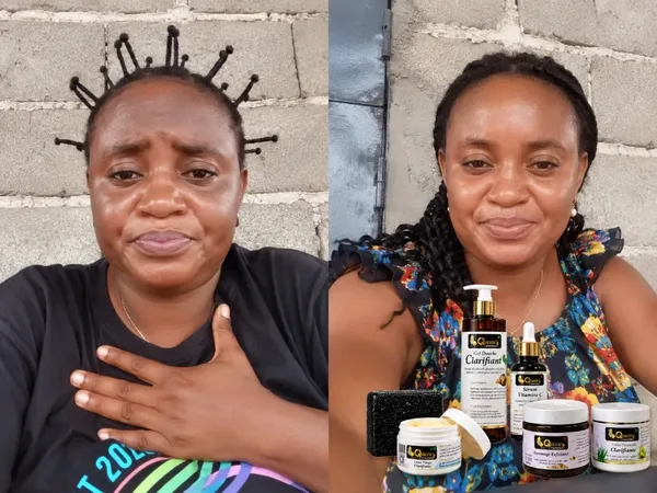 An even complexion, from head to toe.